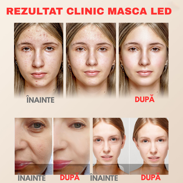 SkinLuxe – Masca LED pentru Îngrijire Premium